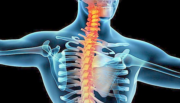 頸椎手術危險高 虛擬骨骼模擬降風險 | 文章內置圖片