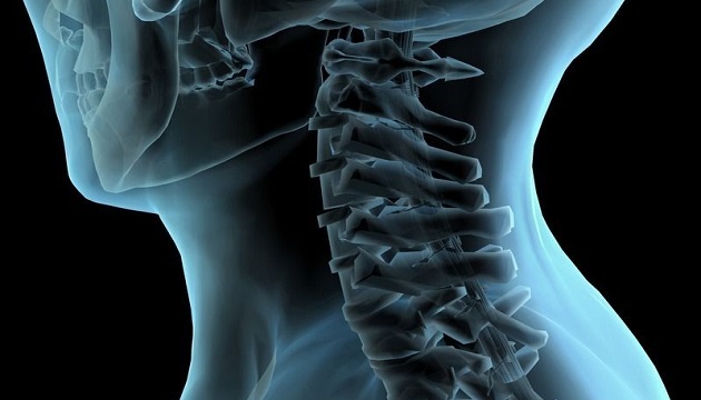 頸椎手術危險高 虛擬骨骼模擬降風險