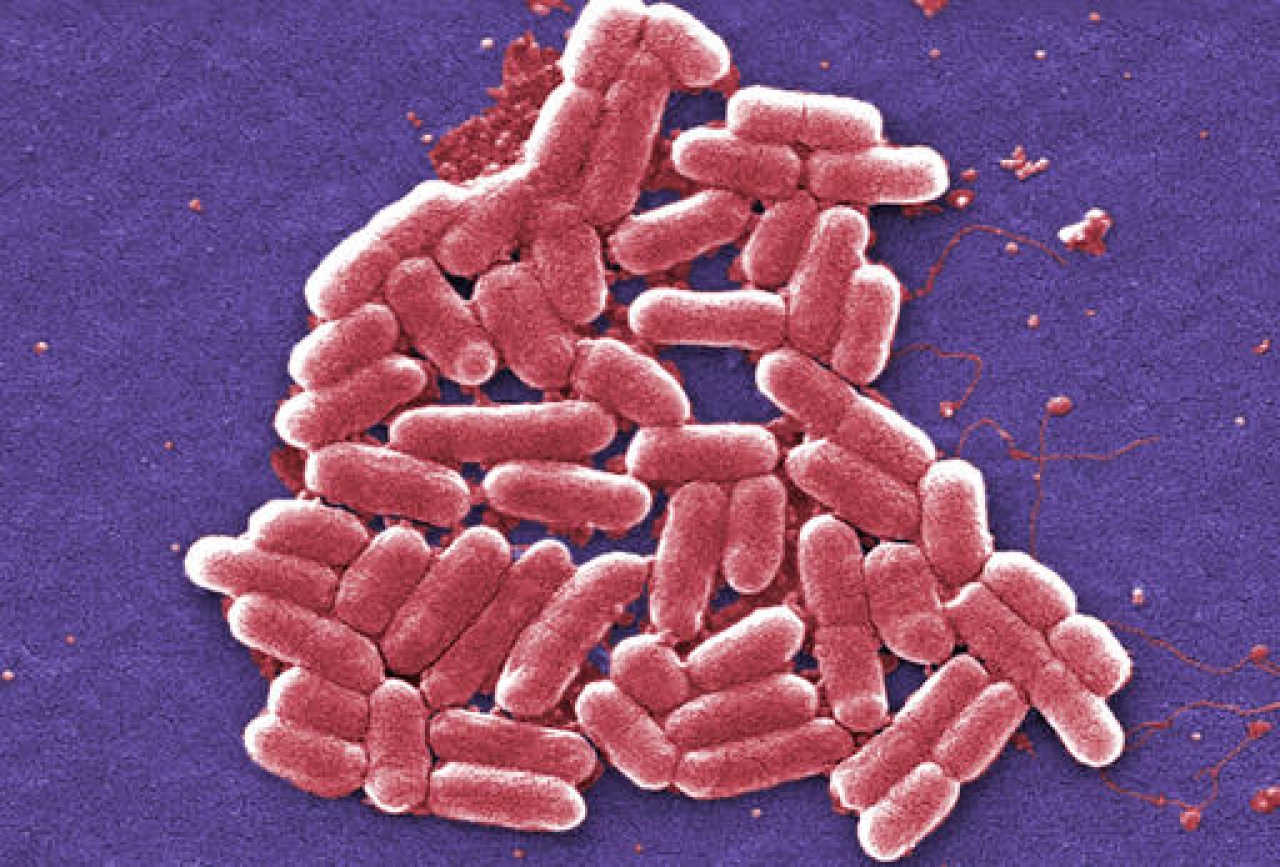 美出現超級細菌病例！「最後防線抗生素」失靈？