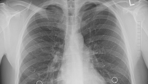 肺就要呼吸不然要幹嘛? 專家:還能造血! | 文章內置圖片