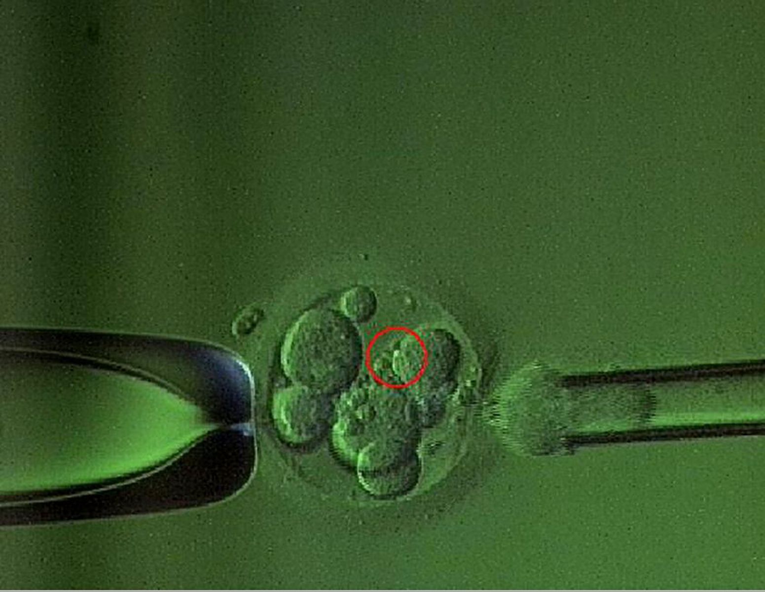 世界唯二 亞洲第一 台灣成果 qPCR胚胎快篩專利 | 文章內置圖片